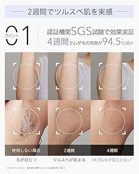 Ulike脱毛器 AirPro Sサファイア冷却技術で無痛22J ハイパワー 正規品】Ulike 脱毛器 AirPro S【メーカー2年保証/サファイア